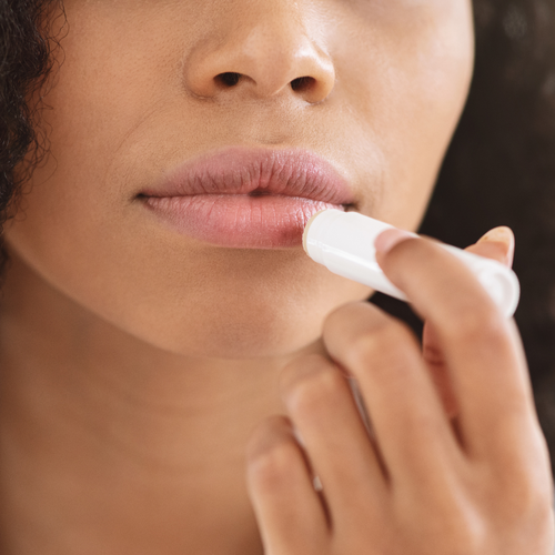 How to heal dry chapped lips in winter